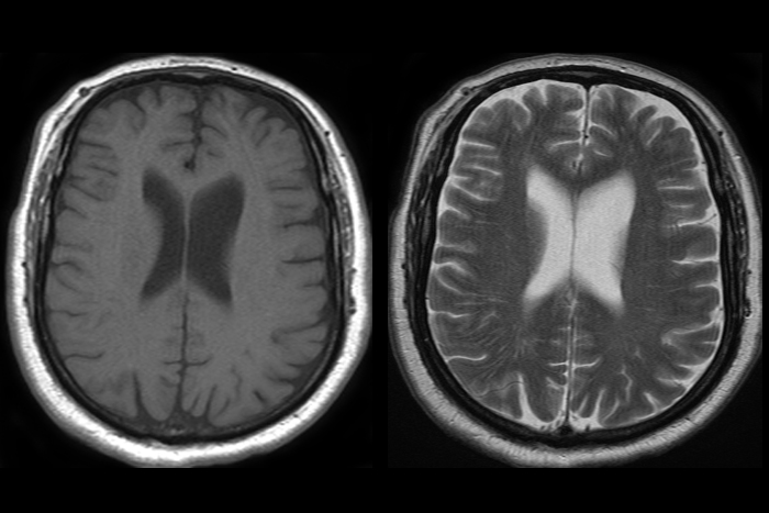 t1w t2w ct scan